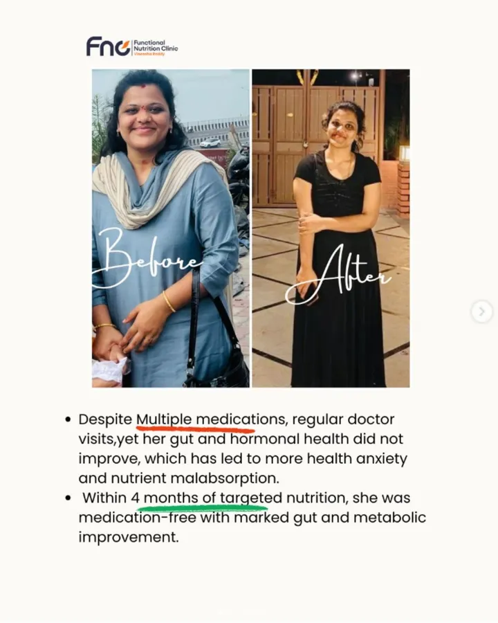 Before and after photos of a client showing her gut and hormonal health transformation after 4 months of targeted nutrition, becoming medication-free with marked metabolic improvement